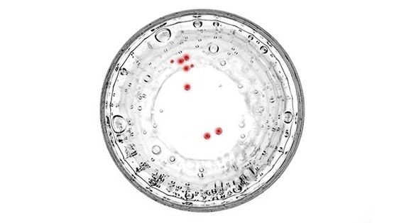 Si vous présentez des symptômes de prostatite, vous devriez subir un test d’infection cachée.
